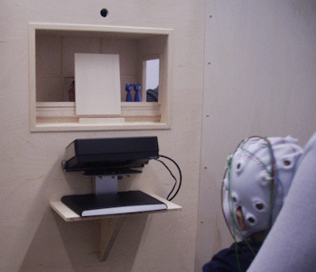 Neurofeedback